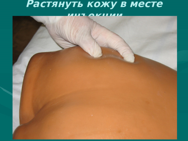 Растянуть кожу в месте инъекции 