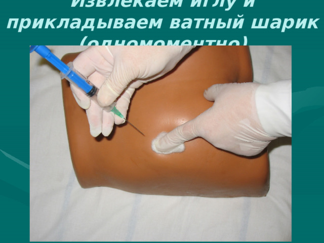Извлекаем иглу и прикладываем ватный шарик (одномоментно) 