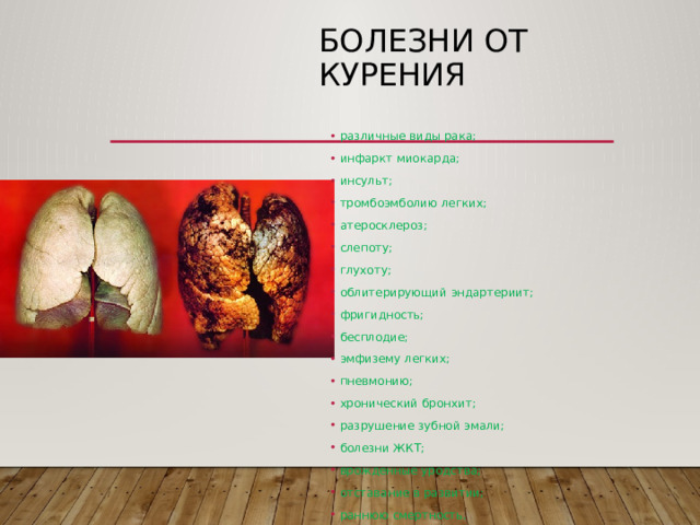 Болезни от курения различные виды рака; инфаркт миокарда; инсульт; тромбоэмболию легких; атеросклероз; слепоту; глухоту; облитерирующий эндартериит; фригидность; бесплодие; эмфизему легких; пневмонию; хронический бронхит; разрушение зубной эмали; болезни ЖКТ; врожденные уродства; отставание в развитии; раннюю смертность. 