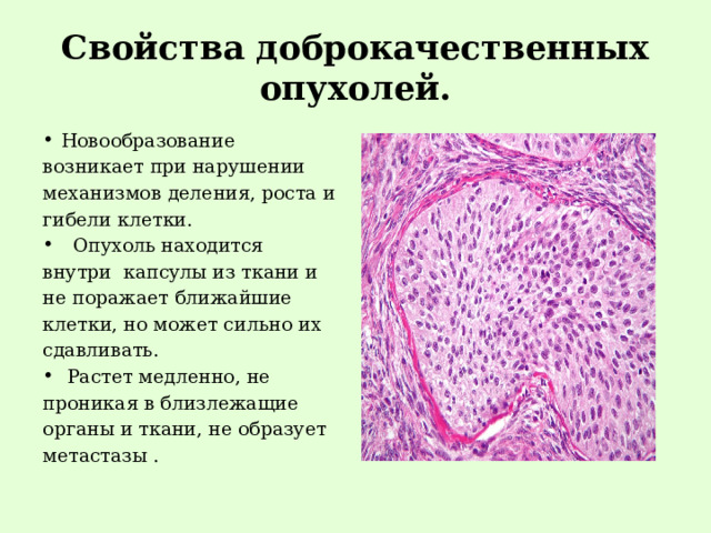 Свойства доброкачественных опухолей. Новообразование возникает при нарушении механизмов деления, роста и гибели клетки.  Опухоль находится внутри капсулы из ткани и не поражает ближайшие клетки, но может сильно их сдавливать.  Растет медленно, не проникая в близлежащие органы и ткани, не образует метастазы . 