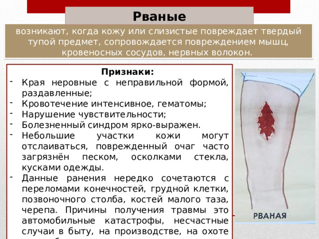 Рваные возникают, когда кожу или слизистые повреждает твердый тупой предмет, сопровождается повреждением мышц, кровеносных сосудов, нервных волокон. Признаки: Края неровные с неправильной формой, раздавленные; Кровотечение интенсивное, гематомы; Нарушение чувствительности; Болезненный синдром ярко-выражен. Небольшие участки кожи могут отслаиваться, поврежденный очаг часто загрязнён песком, осколками стекла, кусками одежды. Данные ранения нередко сочетаются с переломами конечностей, грудной клетки, позвоночного столба, костей малого таза, черепа. Причины получения травмы это автомобильные катастрофы, несчастные случаи в быту, на производстве, на охоте или рыбалке. 