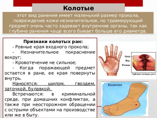 Колотые этот вид ранения имеет маленький размер прокола, повреждение кожи незначительное, но травмирующий предмет очень часто задевает внутренние органы, так как глубина ранения чаще всего бывает больше его диаметра. Признаки колотых ран: - Ровные края входного прокола; - Незначительное покраснение вокруг; - Кровотечение не сильное; - Когда поражающей предмет остается в ране, ее края повернуты внутрь. Наносятся: шилом, гвоздем, заточкой, булавкой. Встречаются: в криминальной среде, при домашних конфликтах, а также при неосторожном обращении с острыми объектами на производстве или же в быту. 