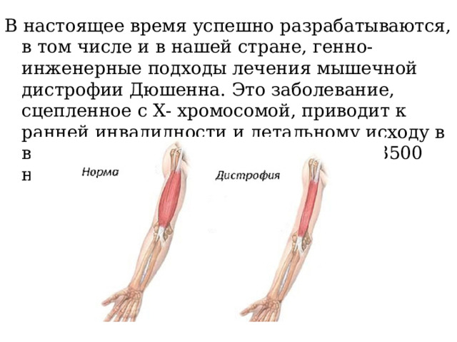 В настоящее время успешно разрабатываются, в том числе и в нашей стране, генно-инженерные подходы лечения мышечной дистрофии Дюшенна. Это заболевание, сцепленное с Х- хромосомой, приводит к ранней инвалидности и летальному исходу в возрасте до 20 лет одного из каждых 3500 новорожденных мальчиков. 