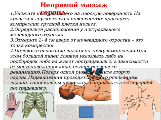 Непрямой массаж сердца 1.Уложите пострадавшего на плоскую поверхность.На кровати и других мягких поверхностях проводить компрессию грудной клетки нельзя. 2.Определите расположение у пострадавшего мечевидного отростка. 3.Отмерьте 2- 4 см вверх от мечевидного отростка – это точка компрессии. 4.Положите основание ладани на точку компрессии.При этом большой палец должен указывать либо на подбородок либо на живот пострадавшего, в зависимости от местоположения лица, осуществляющего реанимацию.Поверх одной руки положите вторую ладонь.Надавливания проводятся строго основанием ладони- ваши пальцы не должны соприкасаться с грудиной пострадавшего. 6 