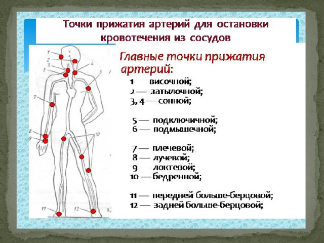 Укажите какое кровотечение изображено на рисунке