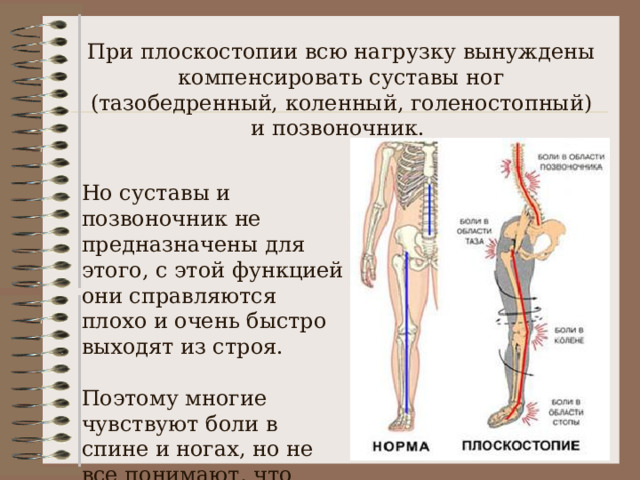 При плоскостопии всю нагрузку вынуждены компенсировать суставы ног (тазобедренный, коленный, голеностопный) и позвоночник. Но суставы и позвоночник не предназначены для этого, с этой функцией они справляются плохо и очень быстро выходят из строя. Поэтому многие чувствуют боли в спине и ногах, но не все понимают, что первопричина всему этому - плоскостопие.  