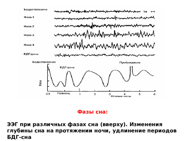 Фазы сна:  ЭЭГ при различных фазах сна (вверху). Изменения глубины сна на протяжении ночи, удлинение периодов БДГ-сна 