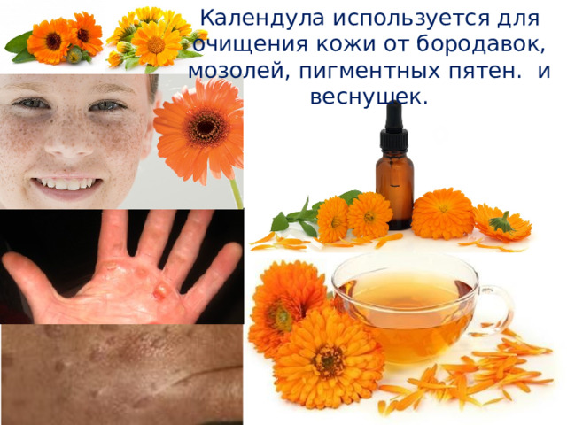 Календула используется для очищения кожи от бородавок, мозолей, пигментных пятен. и веснушек. 