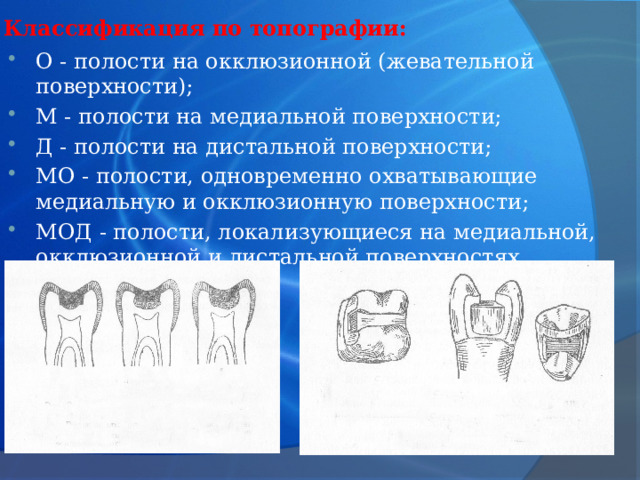 Окклюзионная поверхность. Классификация вкладок в ортопедической стоматологии. Вкладка окклюзионно медиальная дистальная.