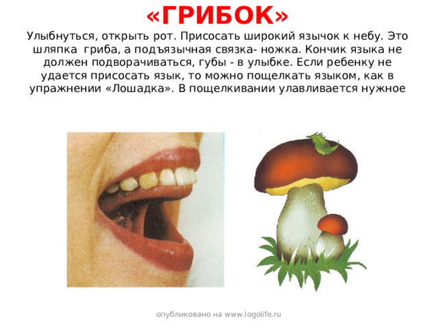 «ГРИБОК»  Улыбнуться, открыть рот. Присосать широкий язычок к небу. Это шляпка гриба, а подъязычная связка- ножка. Кончик языка не должен подворачиваться, губы - в улыбке. Если ребенку не удается присосать язык, то можно пощелкать языком, как в упражнении «Лошадка». В пощелкивании улавливается нужное движение языка.   опубликовано на www.logolife.ru 