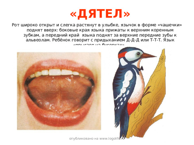 «ДЯТЕЛ» Рот широко открыт и слегка растянут в улыбке, язычок в форме «чашечки» поднят вверх: боковые края языка прижаты к верхним коренным зубкам, а передний край языка поднят за верхние передние зубы к альвеолам. Ребёнок говорит с придыханием Д-Д-Д или Т-Т-Т. Язык «прыгает на бугорках». опубликовано на www.logolife.ru 