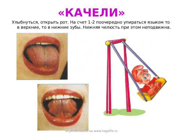 «КАЧЕЛИ» Улыбнуться, открыть рот. На счет 1-2 поочередно упираться языком то в верхние, то в нижние зубы. Нижняя челюсть при этом неподвижна. опубликовано на www.logolife.ru 