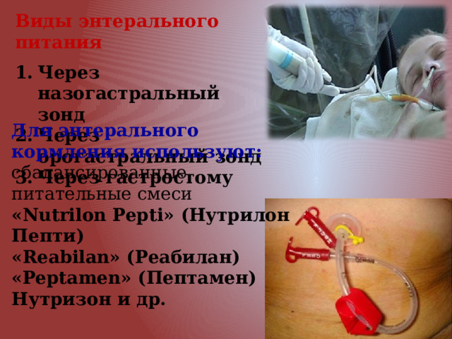 Виды энтерального питания  Через назогастральный зонд Через орогастральный зонд Через гастростому Для энтерального кормления используют: сбалансированные питательные смеси «Nutrilon Pepti» (Нутрилон Пепти) «Reabilan» (Реабилан) «Peptamen» (Пептамен) Нутризон и др. 
