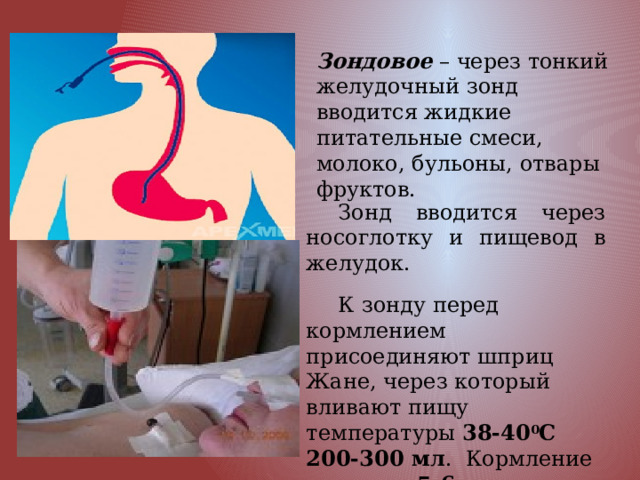 Зондовое – через тонкий желудочный зонд вводится жидкие питательные смеси, молоко, бульоны, отвары фруктов. Зонд вводится через носоглотку и пищевод в желудок. К зонду перед кормлением присоединяют шприц Жане, через который вливают пищу температуры 38-40 0 С 200-300 мл . Кормление проводят 5-6 раз в день. 
