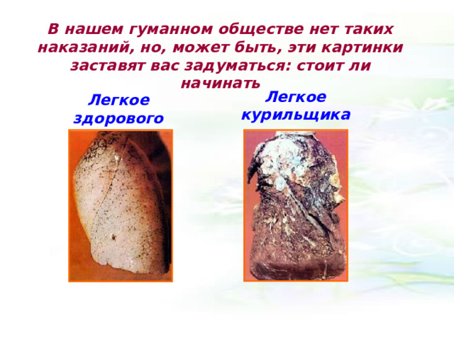 В нашем гуманном обществе нет таких наказаний, но, может быть, эти картинки заставят вас задуматься: стоит ли начинать Легкое курильщика Легкое здорового человека 