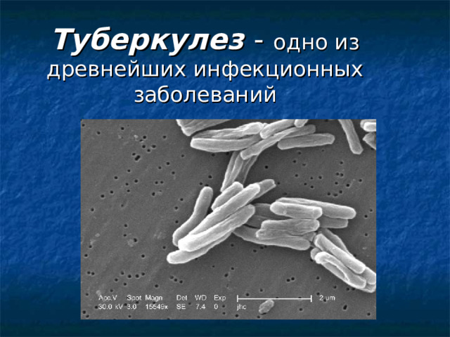 Туберкулез - одно из древнейших инфекционных заболеваний 