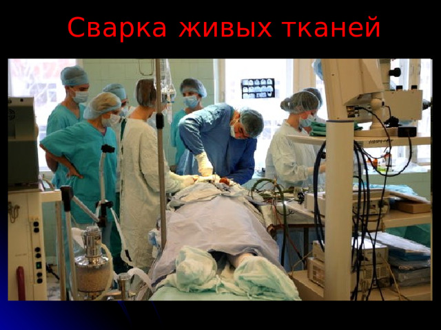 Сварка  живых тканей 