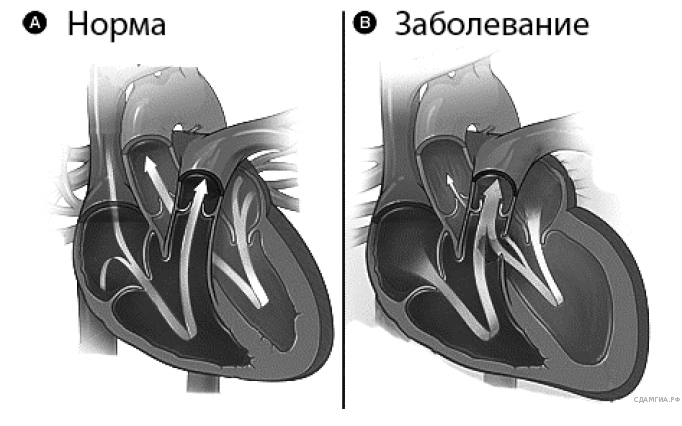 Заболевания сердца ОГЭ. Рассмотрите рисунок с изображением схемы сердца человека. Сердце человека ОГЭ. Заболевания огэ биология