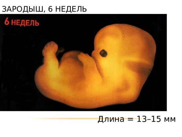 ЗАРОДЫШ, 6 НЕДЕЛЬ Длина = 13–15 мм 