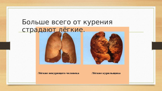 Больше  всего от  курения страдают лёгкие. 