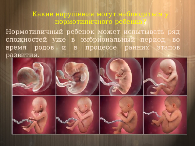 Какие нарушения могут наблюдаться у нормотипичного ребенка? Нормотипичный ребенок может испытывать ряд сложностей уже в эмбриональный период, во время родов и в процессе ранних этапов развития. 