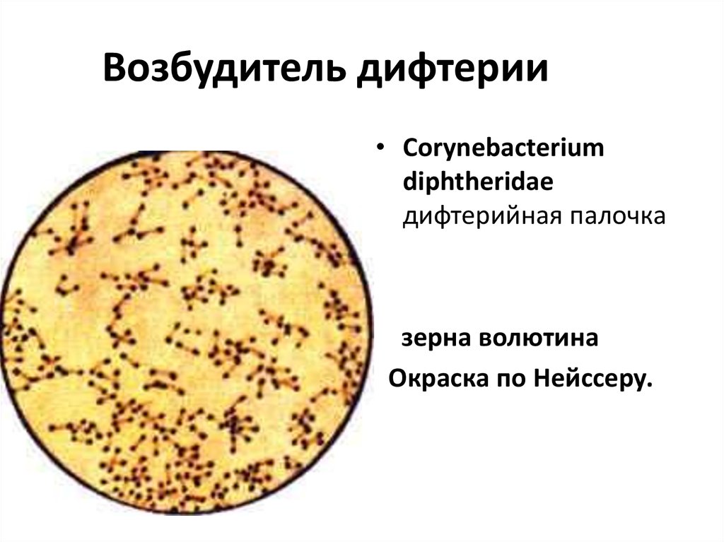 Презентация дифтерия микробиология