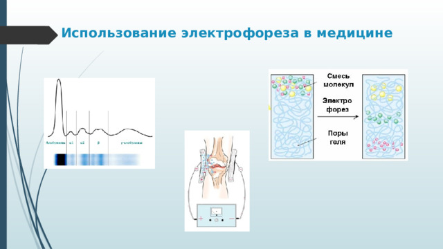 Использование электрофореза в медицине 