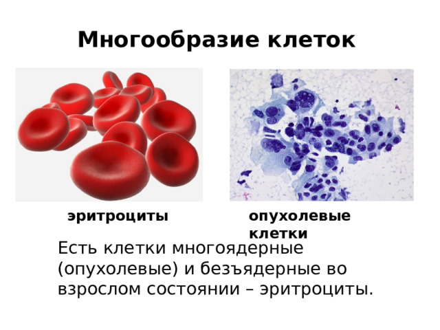Многообразие клеток  эритроциты опухолевые клетки Есть клетки многоядерные (опухолевые) и безъядерные во взрослом состоянии – эритроциты. 