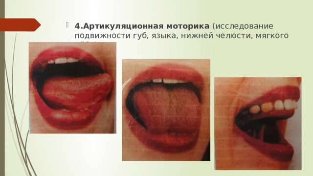 4.Артикуляционная моторика (исследование подвижности губ, языка, нижней челюсти, мягкого нёба). 