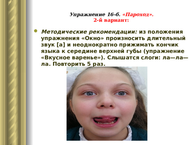 Упражнение 16-б. «Пароход».  2-й вариант: Методические рекомендации: из положения упражнения «Окно» произносить длительный звук [а] и неоднократно прижимать кончик языка к середине верхней губы (упражнение «Вкусное варенье»). Слышатся слоги: ла—ла—ла. Повторить 5 раз. 