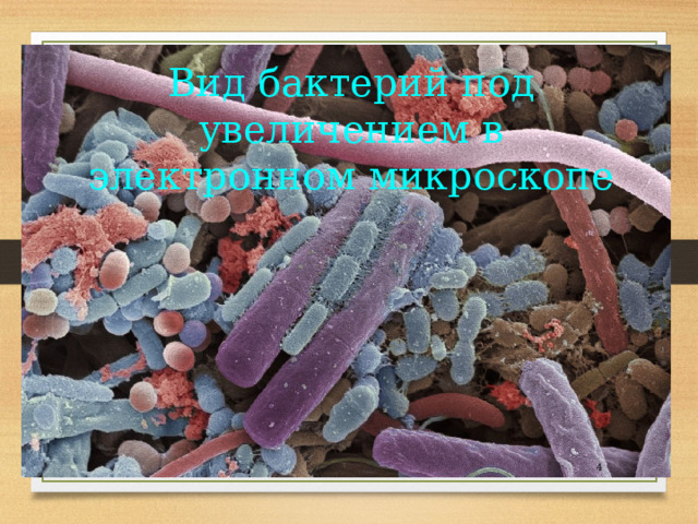 Вид бактерий под увеличением в электронном микроскопе 2 