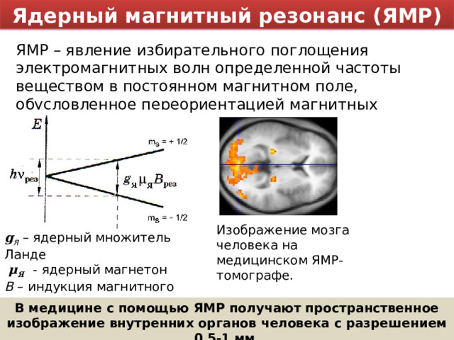 Ядерный магнитный резонанс (ЯМР) ЯМР – явление избирательного поглощения электромагнитных волн определенной частоты веществом в постоянном магнитном поле, обусловленное переориентацией магнитных моментов ядер. Изображение мозга человека на медицинском ЯМР-томографе. g Я  – ядерный множитель Ланде  μ Я  - ядерный магнетон B – индукция магнитного поля В медицине с помощью ЯМР получают пространственное изображение внутренних органов человека с разрешением 0,5-1 мм. 
