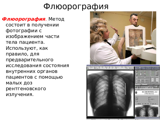 Флюорография Флюорография . Метод состоит в получении фотографии с изображением части тела пациента. Используют, как правило, для предварительного исследования состояния внутренних органов пациентов с помощью малых доз рентгеновского излучения.  