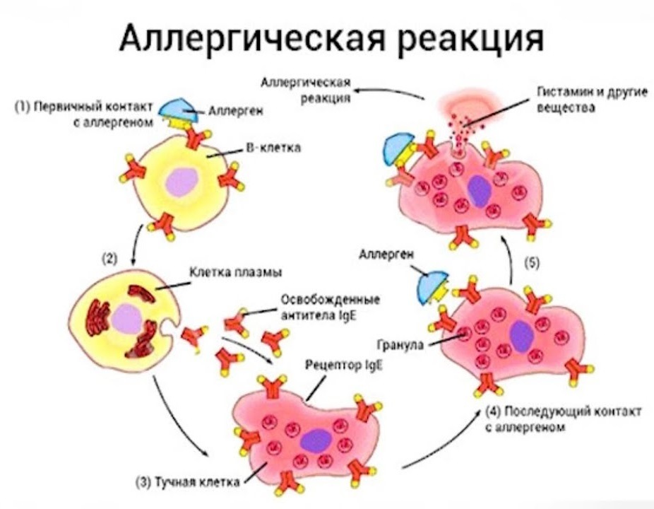 Псориаз иммунология схема