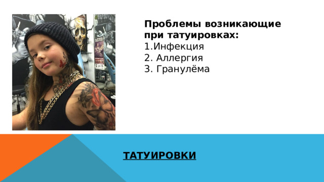 Проблемы возникающие при татуировках: 1.Инфекция 2. Аллергия 3. Гранулёма ТАТУИРОВКИ 