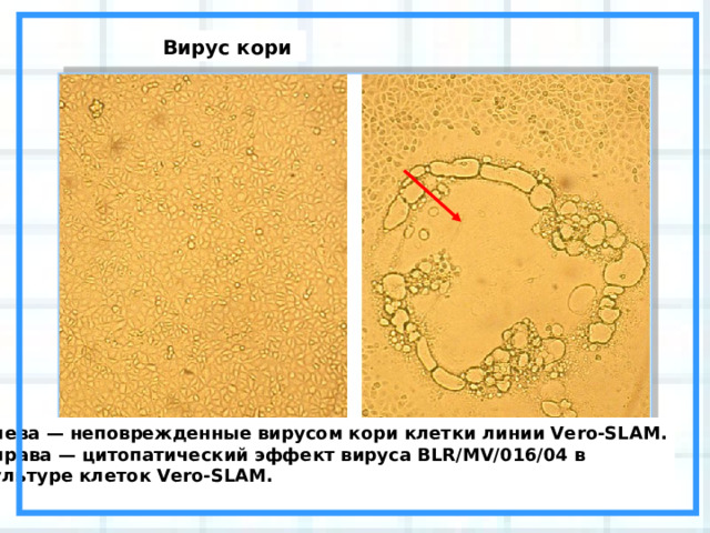 Вирус кори Слева — неповрежденные вирусом кори клетки линии Vero-SLAM.  Справа — цитопатический эффект вируса BLR/MV/016/04 в культуре клеток Vero-SLAM.   