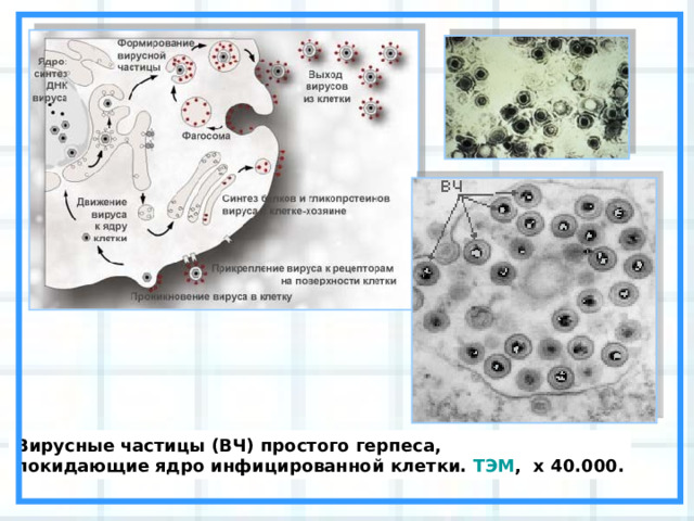 Вирусные частицы (ВЧ) простого герпеса, покидающие ядро инфицированной клетки. ТЭМ ,  x 40.000. 