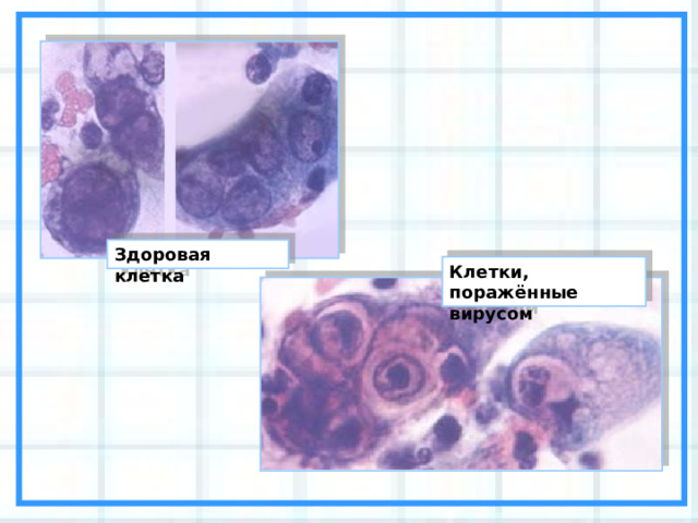 Здоровая клетка Клетки, поражённые вирусом 