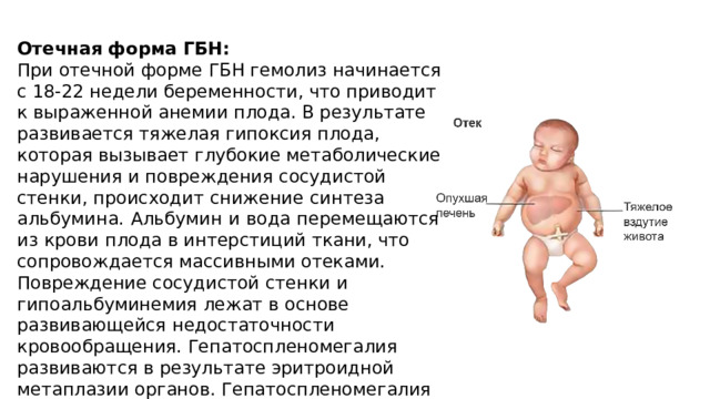 Формы гемолитической болезни новорожденных тест. Анемическая форма гемолитической болезни новорожденных.
