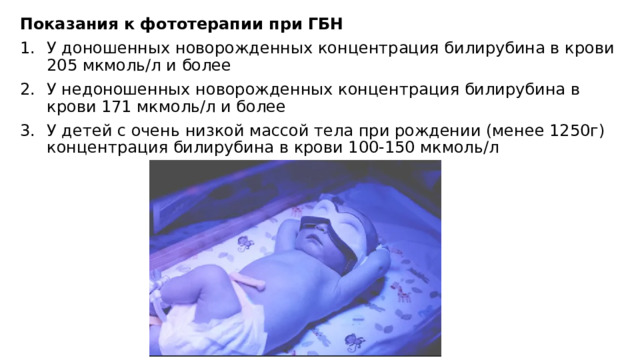 Температура воздуха для доношенного новорожденного должна быть. Фототерапия при гемолитической болезни новорожденных. Показания к фототерапии новорожденных. Фототерапия при гемолитической болезни новорожденных показания. Фототерапия при билирубине новорожденных.