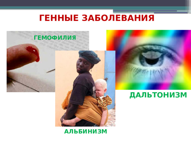 ГЕННЫЕ ЗАБОЛЕВАНИЯ Гемофилия  Дальтонизм Альбинизм 