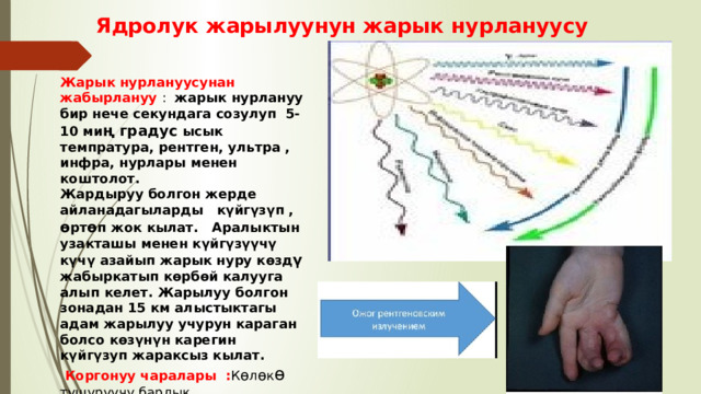 Ядролук жарылуунун жарык нурлануусу Жарык нурлануусунан жабырлануу : жарык нурлануу бир нече секундага созулуп 5-10 ми ң градус ысык темпратура, рентген, ультра , инфра, нурлары менен коштолот. Жардыруу болгон жерде айланадагыларды күйгүзүп , ө рт ө п жок кылат. Аралыктын узакташы менен күйгүзүүчү күчү азайып жарык нуру көзд ү жабыркатып көрбөй калууга алып келет. Жарылуу болгон зонадан 15 км алыстыктагы адам жарылуу учурун караган болсо көзүнүн карегин күйгүзуп жараксыз кылат.  Коргонуу чаралары : К ө л ө к ө түшүрүүчү бардык тоскоолдуктар,түтүн , чаң,туман,жаап жаткан жаан нурдун таасирин азайтат.  