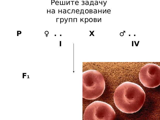 Решите задачу  на наследование  групп крови    Р ♀ . . Х ♂ . .  I  IV    F 1 ? 
