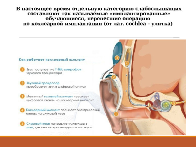 В настоящее время отдельную категорию слабослышащих составляют так называемые «имплантированные» обучающиеся, перенесшие операцию  по кохлеарной имплантации (от лат. cochlea – улитка)  