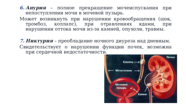 Анурия – полное прекращение мочеиспускания при непоступлении мочи в мочевой пузырь. Анурия – полное прекращение мочеиспускания при непоступлении мочи в мочевой пузырь. Может возникнуть при нарушении кровообращения (шок, тромбоз, коллапс), при отравлениях ядами, при нарушении оттока мочи из-за камней, опухоли, травмы. Никтурия – преобладание ночного диуреза над дневным. Никтурия – преобладание ночного диуреза над дневным. Свидетельствует о нарушении функции почек, возможна при сердечной недостаточности. 