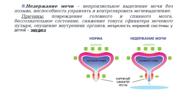 Недержание мочи – непроизвольное выделение мочи без позыва, неспособность управлять и контролировать мочевыделение. Недержание мочи – непроизвольное выделение мочи без позыва, неспособность управлять и контролировать мочевыделение. Причины: повреждение головного и спинного мозга, бессознательное состояние, снижение тонуса сфинктера мочевого пузыря, опущение внутренних органов, незрелость нервной системы у детей – энурез 