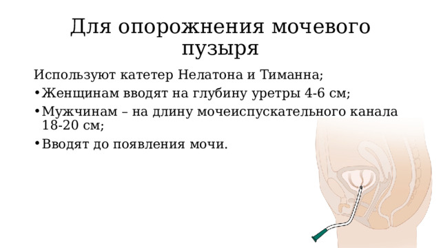 Для опорожнения мочевого пузыря Используют катетер Нелатона и Тиманна; Женщинам вводят на глубину уретры 4-6 см; Мужчинам – на длину мочеиспускательного канала 18-20 см; Вводят до появления мочи. 