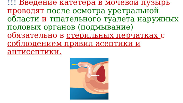 !!! Введение катетера в мочевой пузырь проводят после осмотра уретральной области и тщательного туалета наружных половых органов (подмывание) обязательно в стерильных перчатках с соблюдением правил асептики и антисептики.   