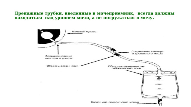  Дренажные трубки, введенные в мочеприемник, всегда должны находиться над уровнем мочи, а не погружаться в мочу.   