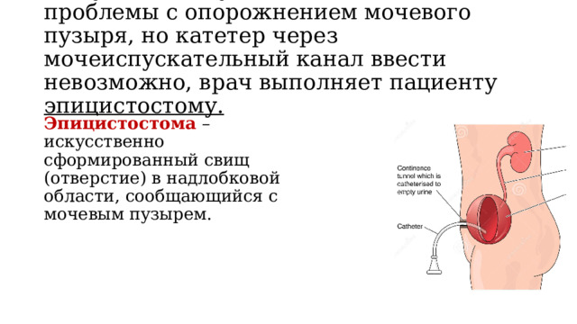 Наружное отверстие мочеиспускательного канала у женщин фото